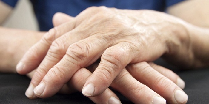 11 remédios caseiros para artrite reumatóide